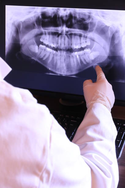 Best Emergency Tooth Extraction in Stroud, OK